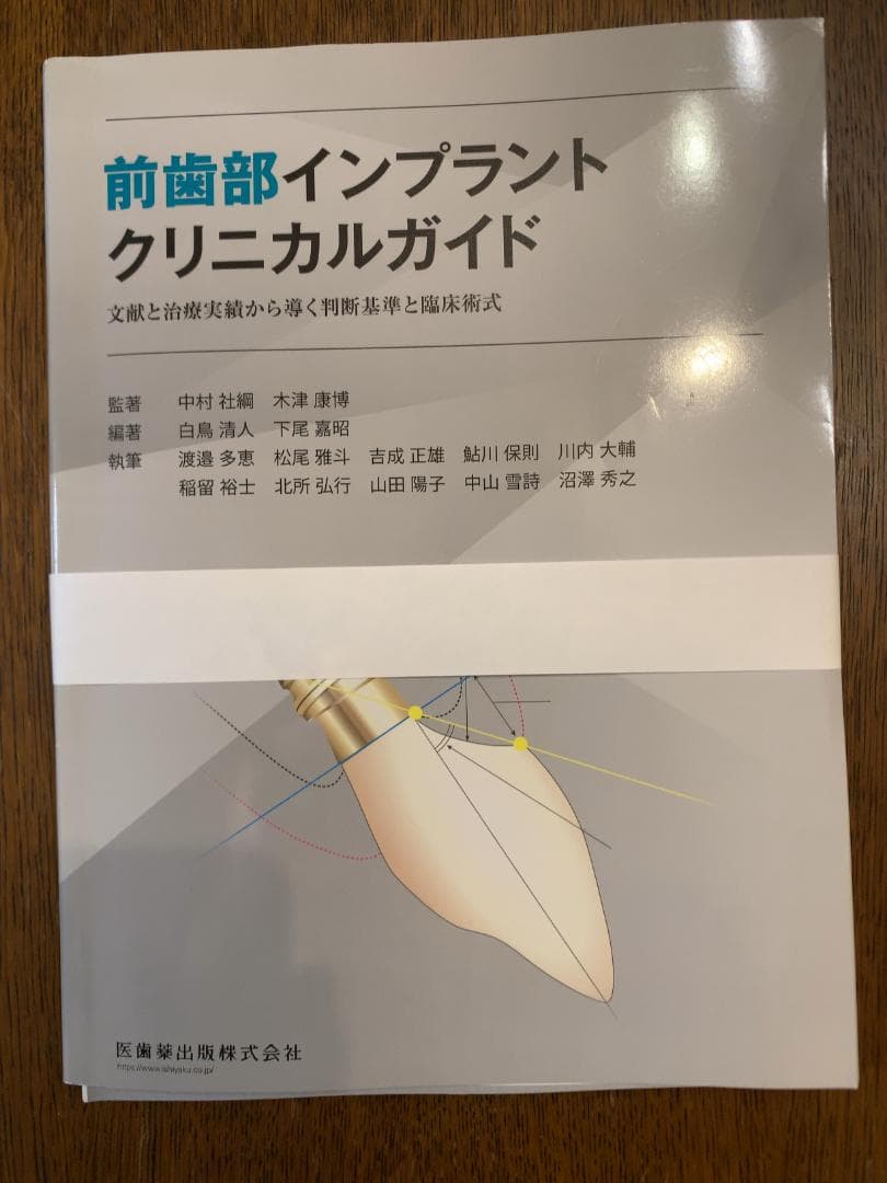 前歯部インプラントクリニカルガイド - メルカリ