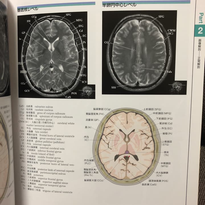 一目でわかる!脳のMRI正常解剖と機能/石藏 礼一, 野崎 園子, 安藤