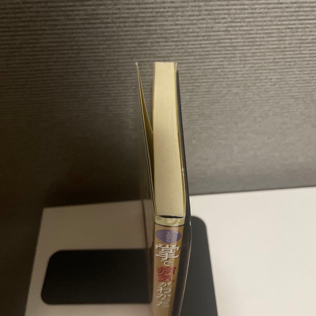 【希少】掌で病気がわかった