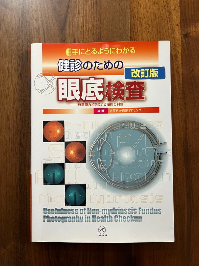 手にとるようにわかる健診のための眼底検査 改訂版 無散瞳カメラによる