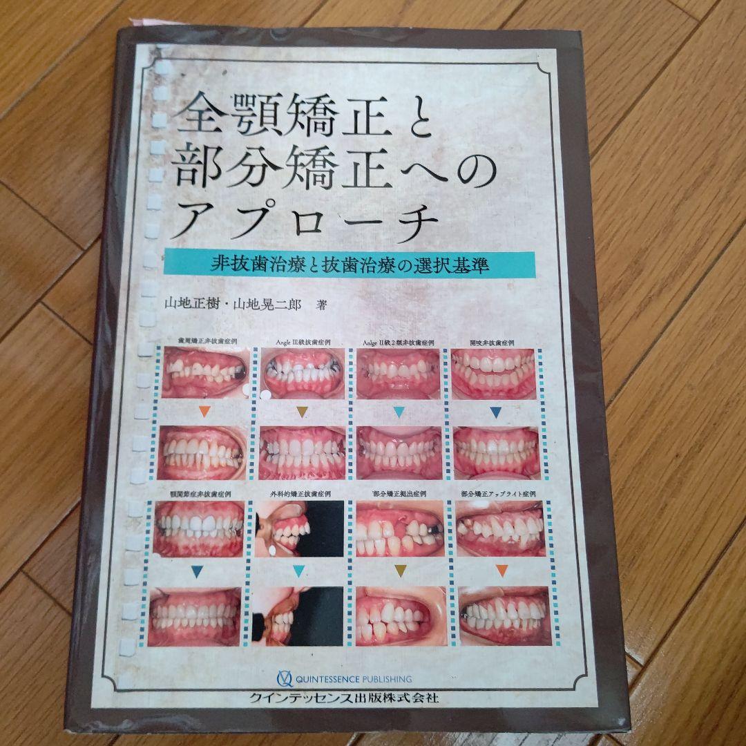 全顎矯正と部分矯正へのアプローチ : 非抜歯治療と抜歯治療の選択基準 上下顎前歯部叢生に対する非抜歯矯正治療 | 福岡天神矯正歯科